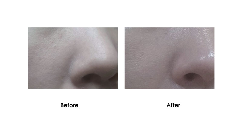 before-after-hydrafusion-pro_0003_3