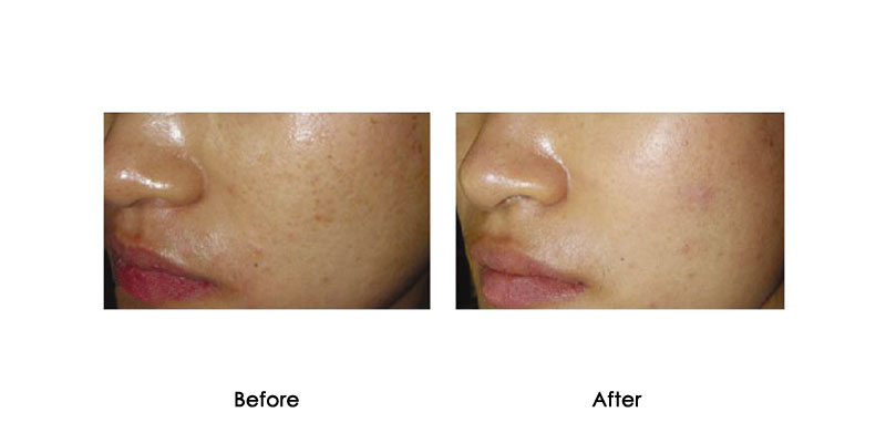 before-after-pepbuw_0001_2