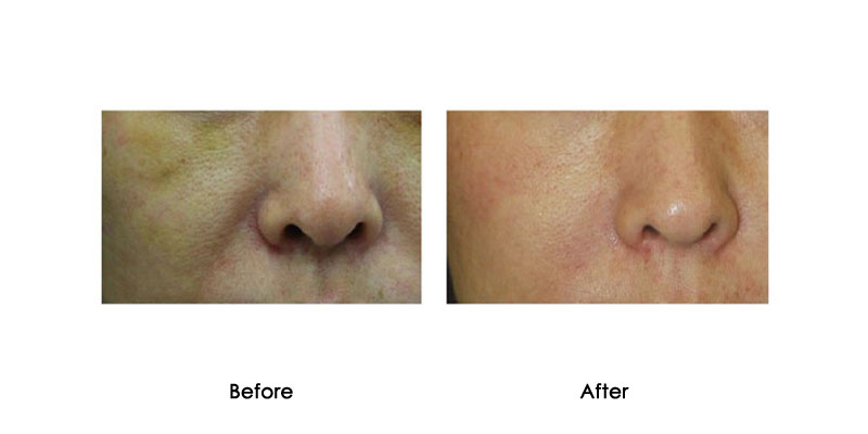 before-after-pepbuw_0002_1