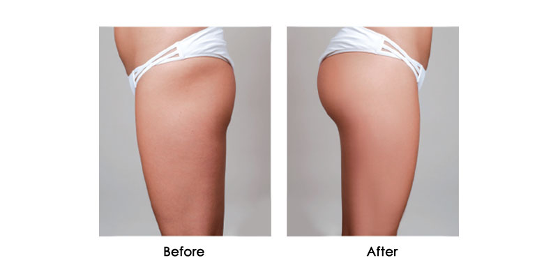 before-after-salus-talent-pro_0000_3
